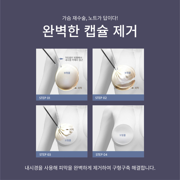 자연스러우면서도 아름다운 가슴을 위한 방법은? 관련 이미지 10