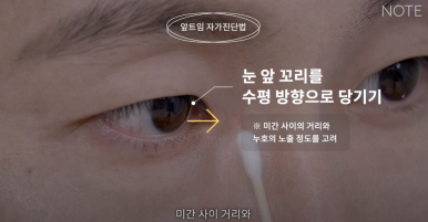 Gangnam Eye Plastic Surgery Clinic: A place that does eye corner surgery well, Nonhyeon Station Note Plastic Surgery explains—Is my eye suitable for corner surgery? Epicanthoplasty, outer canthoplasty, and lower canthoplasty image 10