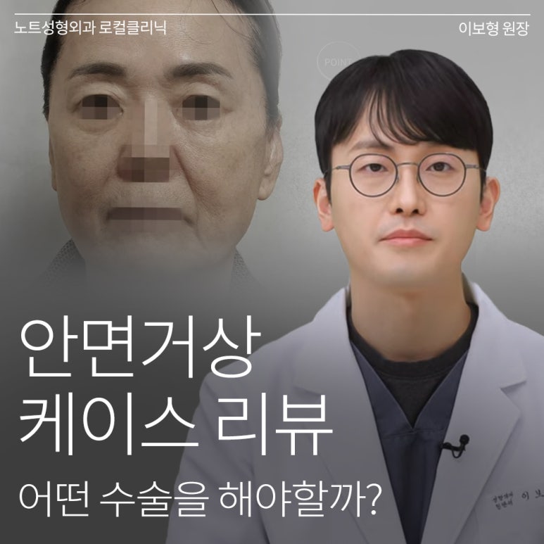 논현 안면거상 성형외과 리프팅 유명한 곳 강남 노트성형외과의 안면거상 케이스 리뷰 수술 전 고민 관련 이미지 1