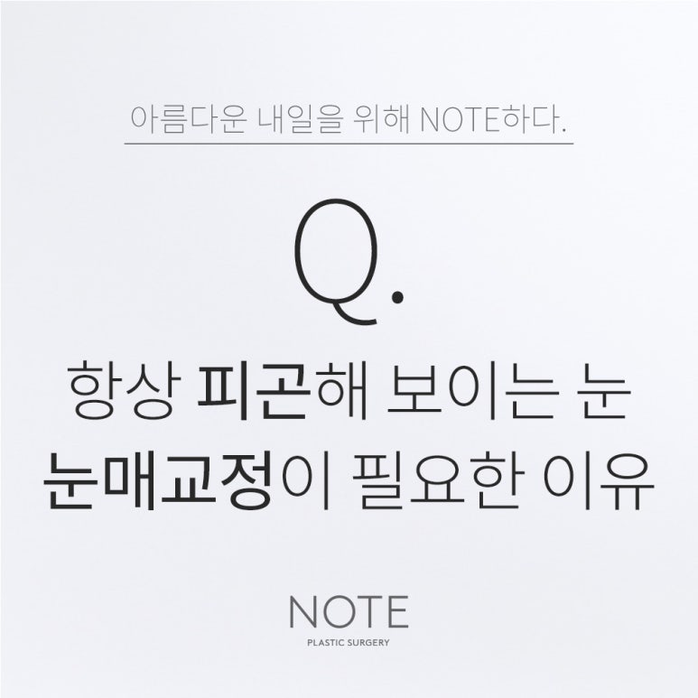논현 눈성형외과 눈매교정 잘하는 곳 강남 노트성형외과가 알려주는 졸린 눈, 피곤한 눈 해결법은? 관련 이미지 1