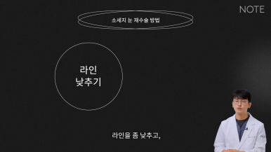 Nonhyeon Revision Eyelid Surgery Plastic Surgery, Famous for Eye Surgery in Gangnam: What Is the “Sausage Eye” Double Eyelid Surgery Side Effect, Says NOTE Plastic Surgery? image 7