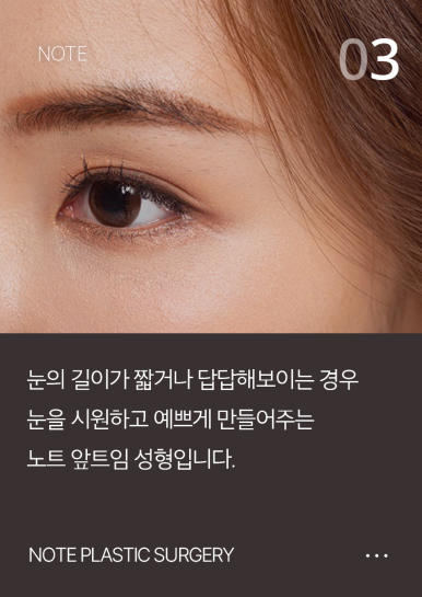 Considering eye corner surgery? Be sure to meet these 3 conditions! Nohte Plastic Surgery, a place known for eye corner surgery image 4