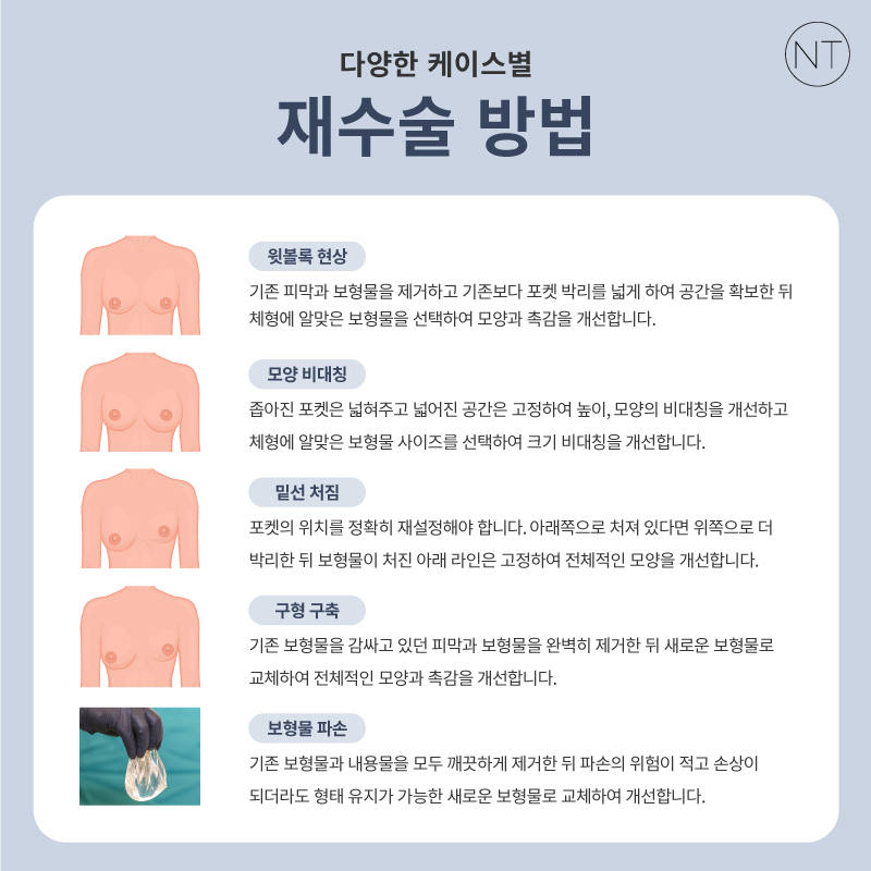 Breast Revision Surgery: Start by Identifying the Exact Cause! image 7