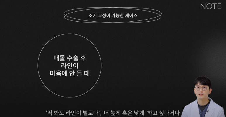 논현 쌍꺼풀재수술 눈재수술 성형외과 유명한 곳 추천 강남 노트성형외과가 말하는 쌍수재수술 시기는? 관련 이미지 18