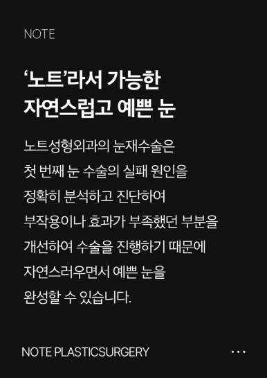 눈재수술 후기가 궁금하다면? 강남 눈재수술 병원 노트성형외과 눈재수술 관련 이미지 5