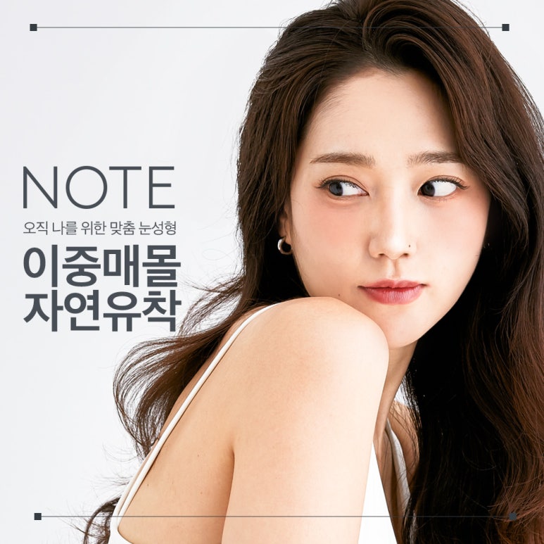 쌍꺼풀수술 전후로 확인하는 쌍꺼풀 비용보다 중요한 논현역 눈성형 잘하는 병원 노트성형외과의 이중 매몰 자연유착 쌍꺼풀수술 포인트 관련 이미지 1
