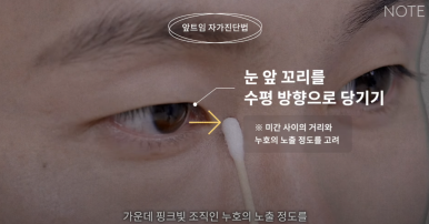 Gangnam Eye Plastic Surgery Clinic: A place that does eye corner surgery well, Nonhyeon Station Note Plastic Surgery explains—Is my eye suitable for corner surgery? Epicanthoplasty, outer canthoplasty, and lower canthoplasty image 11