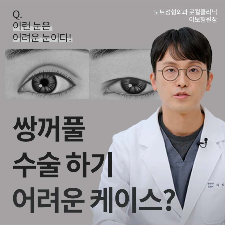 논현 눈성형외과 유명한 곳 강남역 눈성형 노트성형외과의 쌍수 어려운 케이스는? 눈재수술, 안검하수 졸린눈 관련 이미지 1