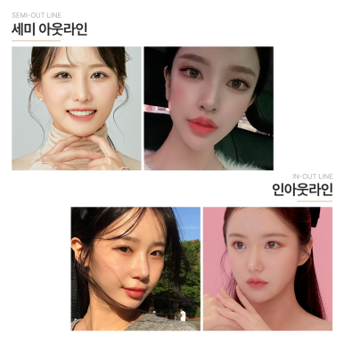 쌍꺼풀 매몰과 트임을 동시에 진행하는 노트만의 올인원 눈성형, 확실한 눈성형 효과를 원한다면? 논현 쌍꺼풀 수술 잘하는 곳, 노트성형외과의 올인원 눈성형 전후 후기 사진 확인하기! 관련 이미지 3
