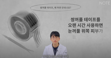Why Not to Use Double-Eyelid Glue or Tape Before Natural Adhesion Non-Incisional Double-Eyelid Surgery, According to Note Plastic Surgery in Nonhyeon, a Gangnam Eye Surgery Clinic Known for Doing Double Eyelid Surgery Well image 3