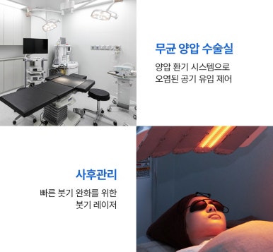 눈매교정을 통해 또렷하고 매력적인 눈매로, 눈성형 잘하는 병원 추천 노트성형외과 눈매교정 관련 이미지 8