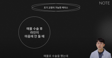 논현 쌍꺼풀재수술 눈재수술 성형외과 유명한 곳 추천 강남 노트성형외과가 말하는 쌍수재수술 시기는? 관련 이미지 17