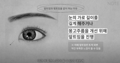 Double Eyelid Surgery: Is There a Procedure That Makes the Eyes Even Prettier When Done Together? A Great Place for Eye Plastic Surgery in Gangnam — NOTE Plastic Surgery: Canthoplasty, Ptosis Correction, and Forehead Lift image 17