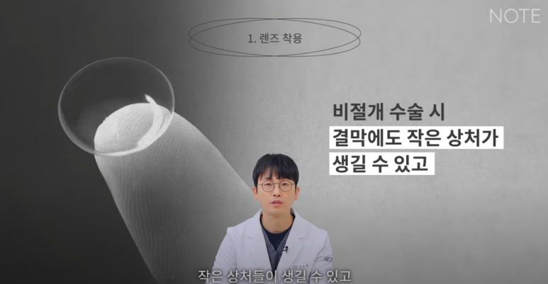 강남 눈성형외과 눈수술 잘하는 곳 논현역 노트성형외과의 쌍꺼풀수술 후 주의사항, 눈성형 후 렌즈 화장이 가능한 건 언제? 관련 이미지 5