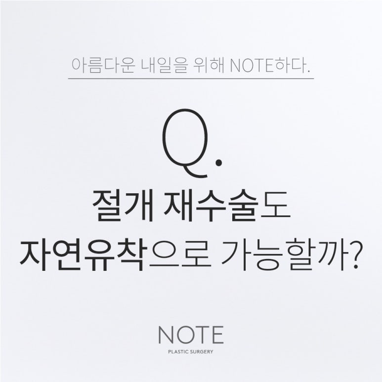 강남 쌍꺼풀 자연유착 눈성형 잘하는 곳 추천 논현 노트성형외과의 절개 재수술도 자연유착으로 가능한가요? 관련 이미지 1