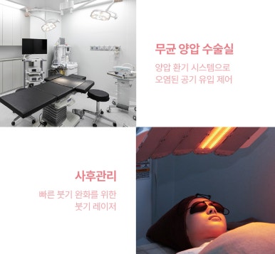 강남 쌍꺼풀재수술, 실패없는 내 눈을 위한 마지막 눈성형, 논현 눈성형 잘하는 곳 노트성형외과 맞춤 눈재수술 관련 이미지 8