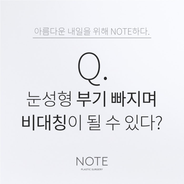 강남 쌍꺼풀수술 눈성형 잘하는 곳 추천 논현 노트성형외과의 부기 빠질 때 양쪽 눈 대칭 어긋날 수 있나요? 관련 이미지 1
