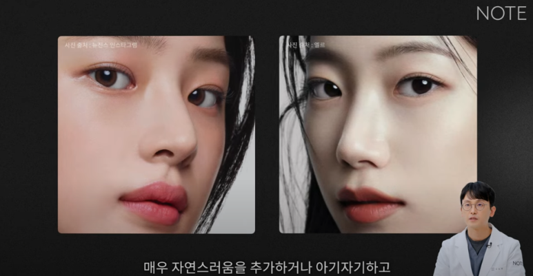 논현역 눈성형 잘하는 곳 노트성형외과의 인라인, 인아웃라인, 아웃라인 쌍꺼풀라인별 쌍꺼풀수술 후 느낌 미리보기 관련 이미지 5