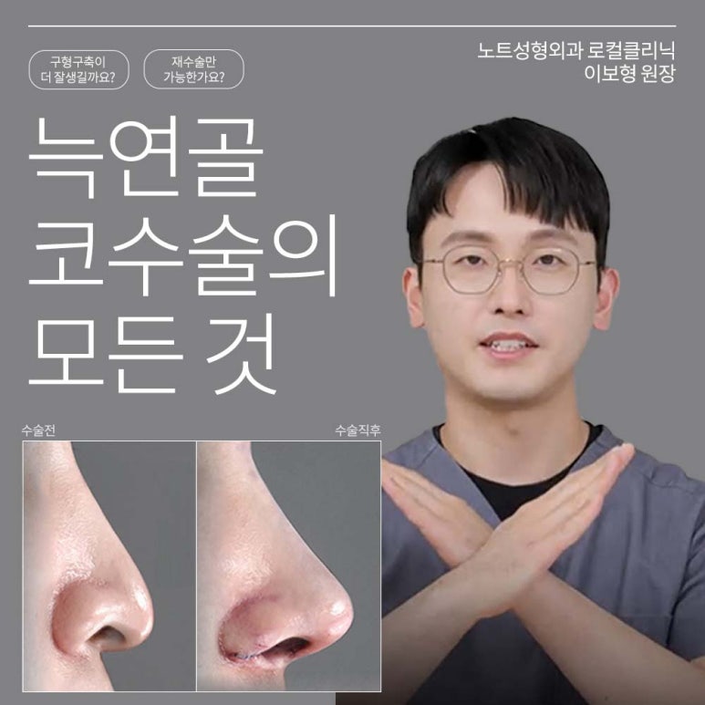 Recommended place for rhinoplasty in Gangnam: Nohyeon Note Plastic Surgery explains the difference between autologous rib cartilage and donated rib cartilage! image 1