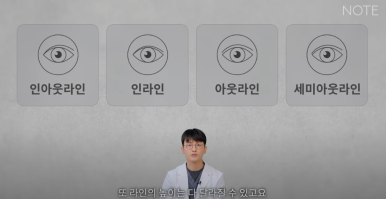 강남 남자눈성형외과 눈수술 잘하는 곳 추천 노트성형외과의 남자속쌍커풀수술 무쌍눈매교정 여자눈성형과의 차이점 관련 이미지 6