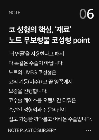 자연스럽고, 화려한 코라인을 원한다면? 부작용 걱정 없는 강남코성형 잘하는곳, 노트성형외과 관련 이미지 7