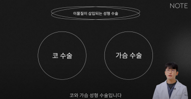 논현역 코수술 추천 코성형 잘하는 곳 강남 노트성형외과의 코수술 후 실리콘 보형물 교체를 해야하는 경우는? 관련 이미지 5