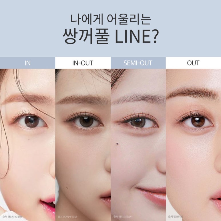 논현 자연유착 쌍수 잘하는 곳 추천 강남 노트성형외과의 티 나지 않는 라인으로 만드는 내 것 같은 눈매 관련 이미지 6
