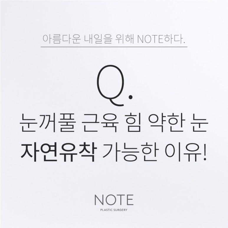 강남 쌍수 자연유착 눈성형 잘하는 곳 논현 노트성형외과의 자연유착 쌍수 눈꺼풀 근육이 약해도 가능할까? 관련 이미지 1