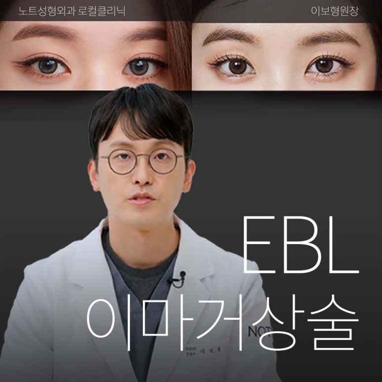 강남 성형외과 이마거상 잘하는 곳 논현역 노트성형외과의 이마거상 리프팅 전후 효과가 좋은 케이스는? 관련 이미지 1