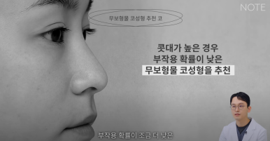 Recommended Gangnam Rhinoplasty Clinic: About Implant-Free Rhinoplasty and Standard Rhinoplasty, as explained by Note Plastic Surgery in Nonhyeon, where nose surgery is done well image 16