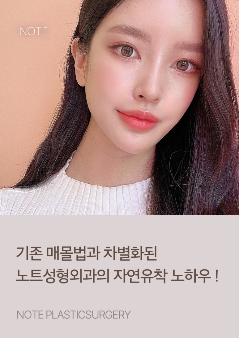 강남 눈성형 잘하는 곳, 노트성형외과의 자연유착 쌍꺼풀 수술 관련 이미지 3