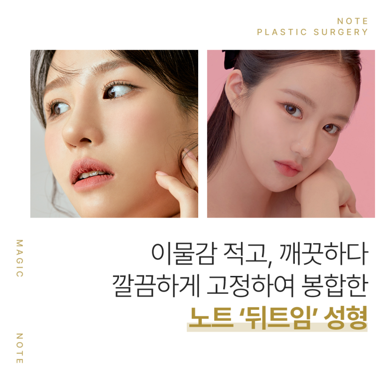 트임 성형 후기로 알아보는 논현역 앞트임 뒷트임 잘하는 곳 노트성형외과의 크고 시원한 눈매를 결정하는 눈트임 종류가 궁금하다면? 관련 이미지 4