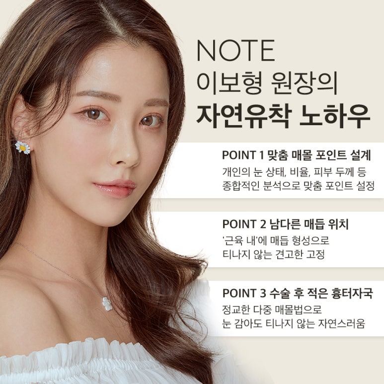 강남 눈성형 잘하는 곳, 자연유착 효과는? 노트성형외과의 오래가는 다중매몰 자연유착 쌍꺼풀수술 잘하는 곳 관련 이미지 5
