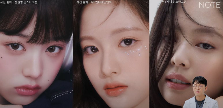 올인원 눈성형으로 매몰과 트임을 동시에! 나에게 맞는 맞춤형 눈성형, 논현역 눈성형 잘하는 곳 노트성형외과 추천 관련 이미지 7