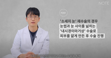 Recommended Gangnam Eye Plastic Surgery Clinic for Double Eyelid Surgery: What If You Have Thick Skin at Nonhyeon Note Plastic Surgery? Secondary Revision for Sausage Eyes! Forehead Lift! image 10