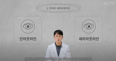 논현역 눈성형 잘하는 곳 노트성형외과의 인라인, 인아웃라인, 아웃라인 쌍꺼풀라인별 쌍꺼풀수술 후 느낌 미리보기 관련 이미지 9