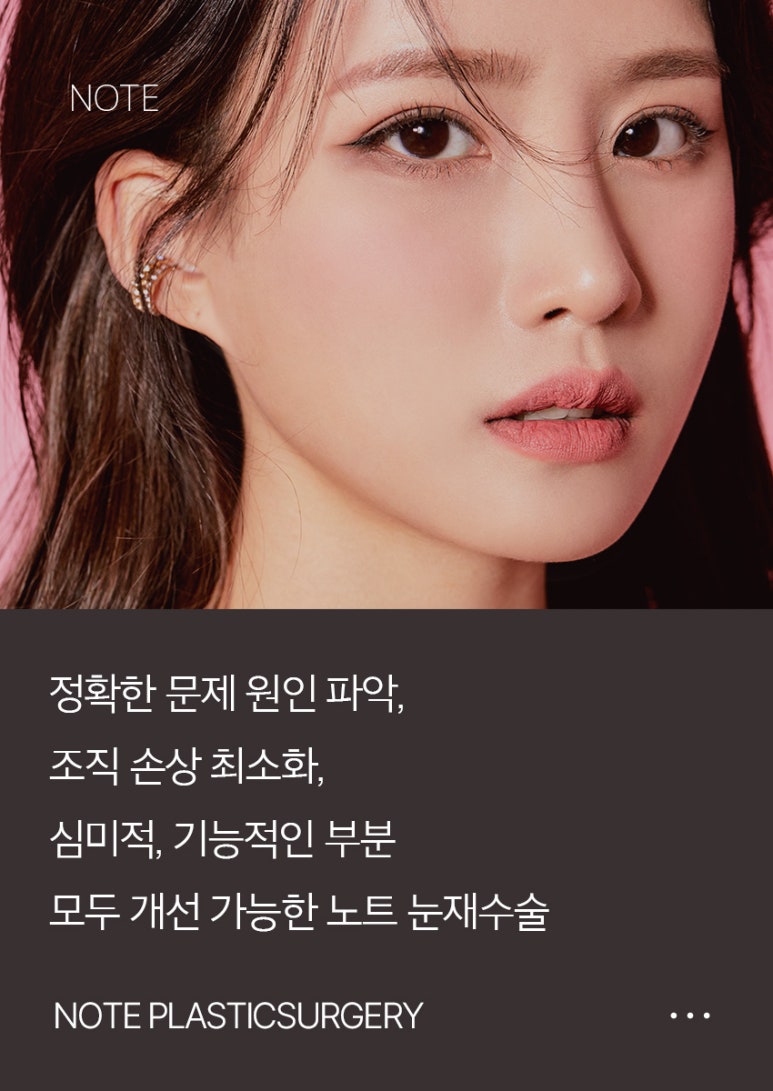 눈재수술 후기가 궁금하다면? 강남 눈재수술 병원 노트성형외과 눈재수술 관련 이미지 6