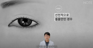 꺼진 눈이 생기는 이유는 따로 있다? 강남 눈성형 잘하는 곳 추천 노트성형외과의 눈꺼짐 해결을 위한 쌍커풀성형과 눈매교정, 지방이식수술 관련 이미지 21