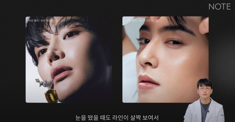 Male Eye Surgery: If You’re Not Sure Which Double Eyelid Suits You, Preview of Note Plastic Surgery’s Male Monolid Double-Eyelid Line Surgery Method at Nonhyeon Station, a Place Known for Male Eye Surgery! image 16