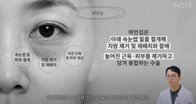 논현 눈성형외과 추천 하안검수술 눈밑지방재배치 잘하는 곳 강남 노트성형외과의 중년 눈성형 케이스 비교 분석 관련 이미지 12