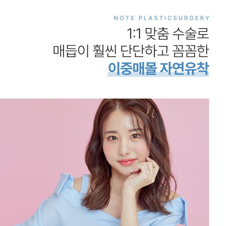 강남 눈성형 잘하는 병원, 자연유착 효과는? 노트성형외과의 오래가는 이중매몰 쌍꺼풀수술 관련 이미지 3