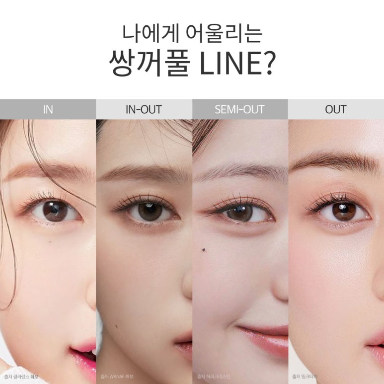 논현 자연유착 쌍수 잘하는 곳 강남 노트성형외과의 자연유착 눈성형수술로 가볍게 눈매에 선명함을 더하는 변화 관련 이미지 6