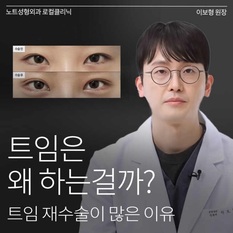 강남 쌍꺼풀수술 트임 눈성형 잘하는 곳 추천 논현 노트성형외과의 트임 재수술이 많은 이유 관련 이미지 1