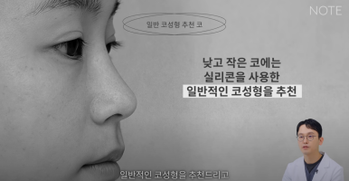 Recommended Gangnam Rhinoplasty Clinic: About Implant-Free Rhinoplasty and Standard Rhinoplasty, as explained by Note Plastic Surgery in Nonhyeon, where nose surgery is done well image 14