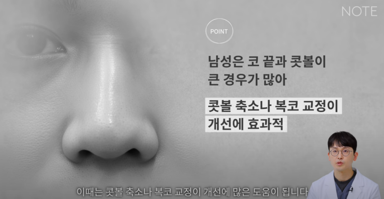 논현 코수술 남자코성형외과 유명한 곳 추천 강남 노트성형외과가 말하는 남자콧볼축소와 남자복코수술 방법은? 관련 이미지 7