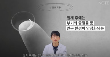 강남 눈성형외과 눈수술 잘하는 곳 논현역 노트성형외과의 쌍꺼풀수술 후 주의사항, 눈성형 후 렌즈 화장이 가능한 건 언제? 관련 이미지 6