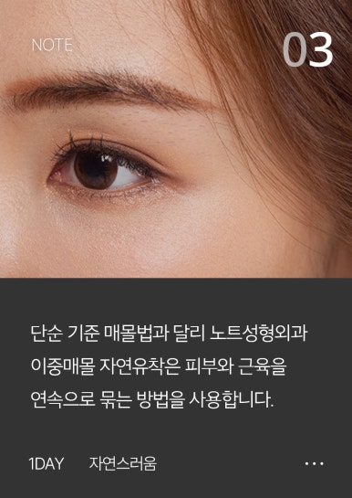 Nonhyeon Station NOTE Plastic Surgery Natural Adhesion for a Natural Look That Doesn’t Show Even When You Close Your Eyes 💗 image 4