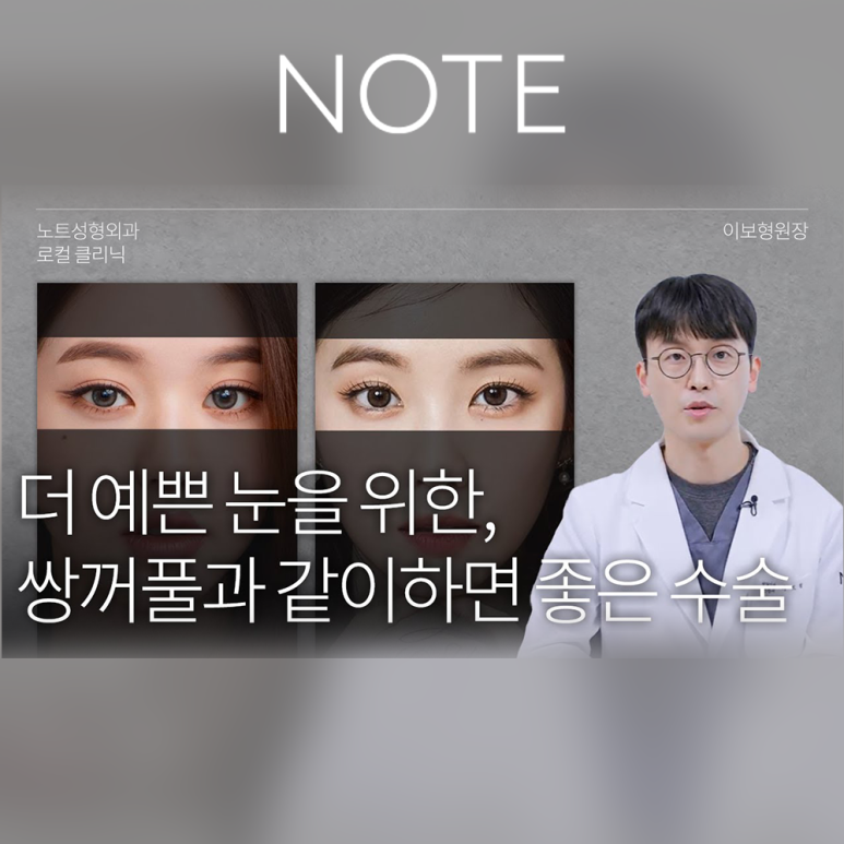 Double Eyelid Surgery: Is There a Procedure That Makes the Eyes Even Prettier When Done Together? A Great Place for Eye Plastic Surgery in Gangnam — NOTE Plastic Surgery: Canthoplasty, Ptosis Correction, and Forehead Lift image 1