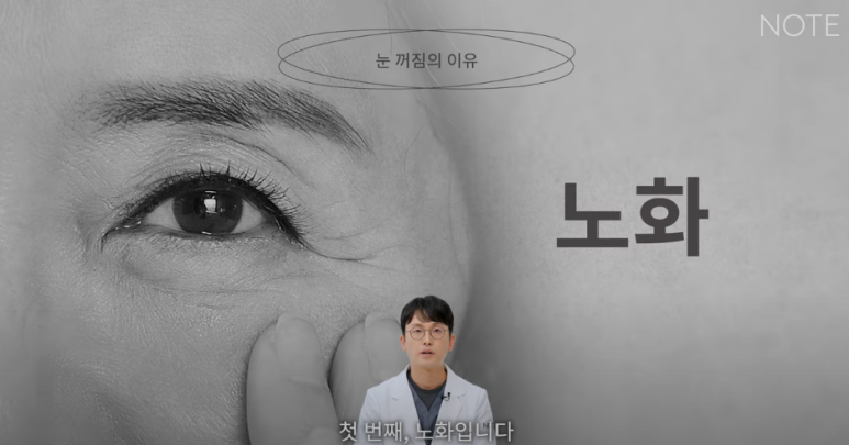 꺼진 눈이 생기는 이유는 따로 있다? 강남 눈성형 잘하는 곳 추천 노트성형외과의 눈꺼짐 해결을 위한 쌍커풀성형과 눈매교정, 지방이식수술 관련 이미지 16