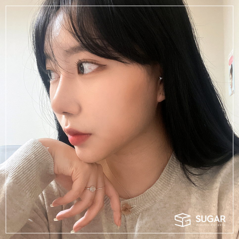 기증늑 자가늑 어떤게 좋을까? 관련 이미지 4
